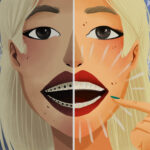 digital illustration of a before an after with braces